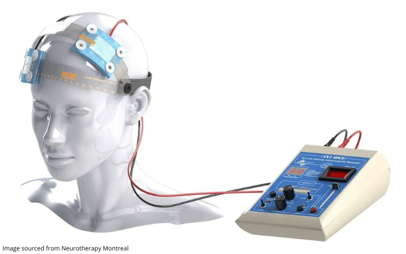 Diagram of Transcranial Direct Current Stimulation (tDCS) machine